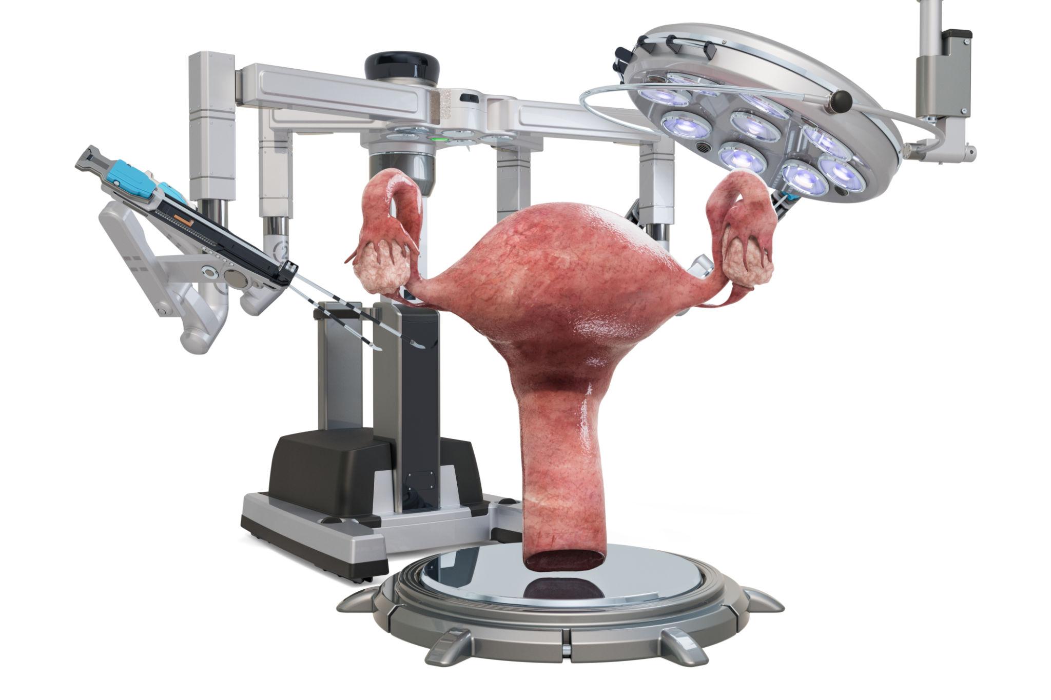 Robotic Radical Hysterectomy Surgery in Pune – Advanced Cancer Treatment